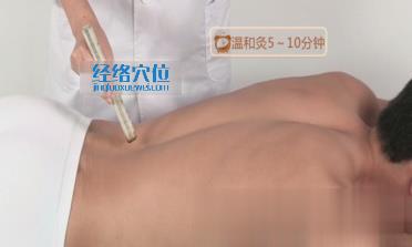 命門穴