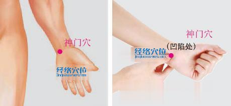 神門穴