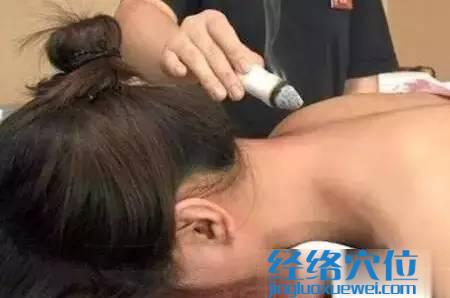 艾灸示范圖