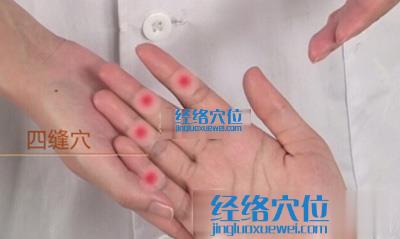 四縫穴位位置圖 四縫穴位位置圖