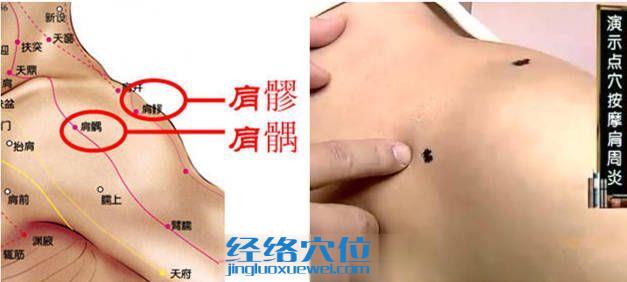 肩髎穴位圖