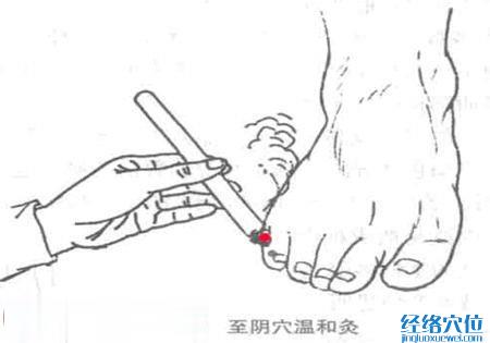 艾灸至陰穴