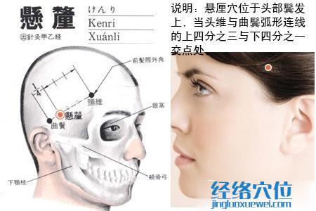 懸厘穴位圖