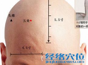 五處穴的準確位置圖