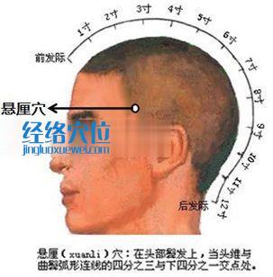 懸厘穴的位置圖