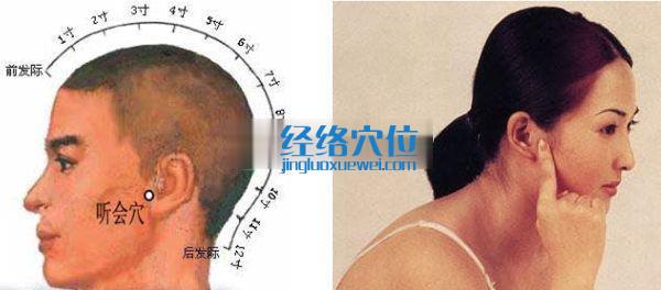 聽會穴位位置圖