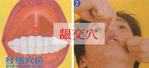 齦交穴的準確位置
