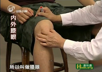 內膝眼、外膝眼治療膝關節疼痛、酸、以及骨刺的形成、膝關節積水