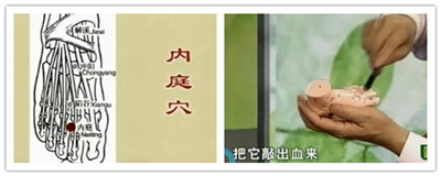 治療上牙齒疼痛的穴位：內庭穴的位置圖