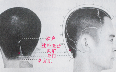 風府穴的位置