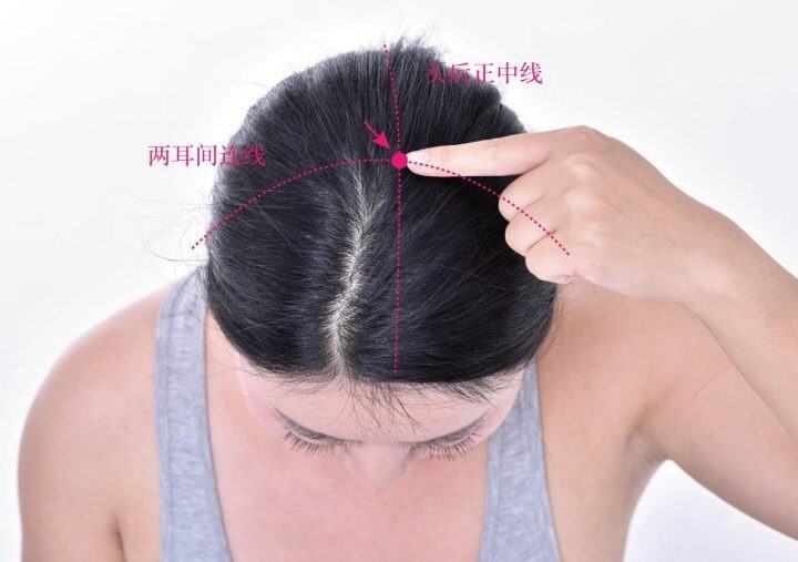 百會(huì)穴.jpg